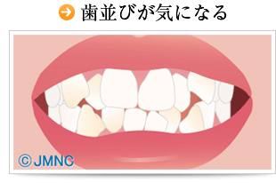 歯並びが気になる